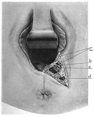 Illustration for article titled A Brief History Of Vaginal Cutting During Childbirth